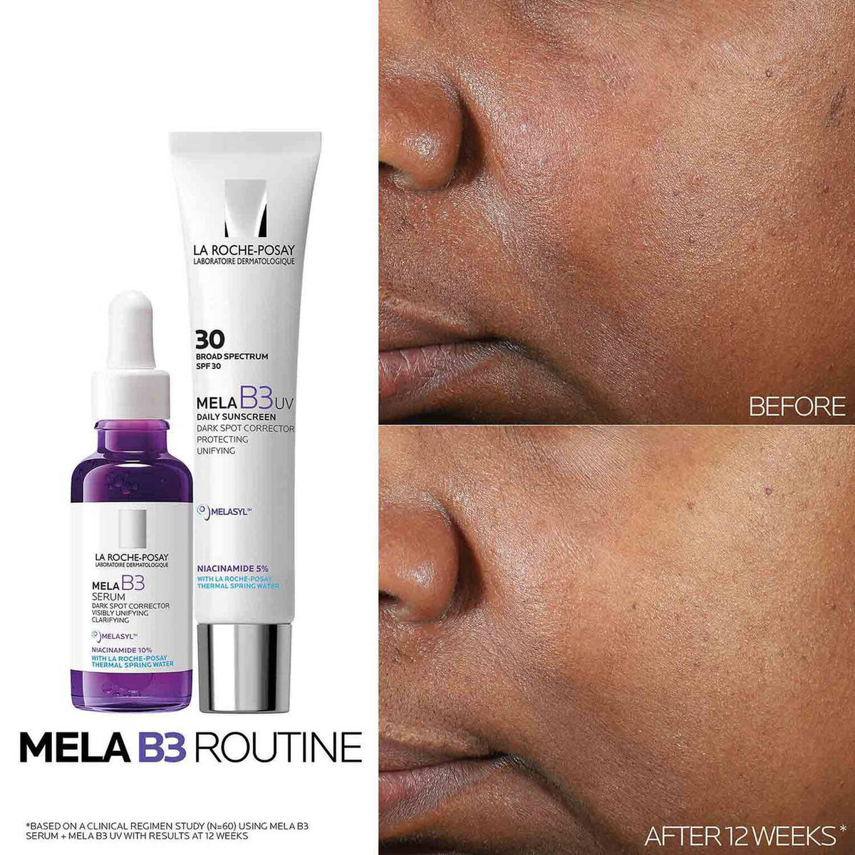 mela-b3-dark-spot-serum-and-mela-b3-uv-daily-moisturizer-with-spf-30-d8 3-Mela-B3-routine_1500X1500.jpg 3-Mela-B3-routine_1500X1500_699afb5eaaaf.jpg
