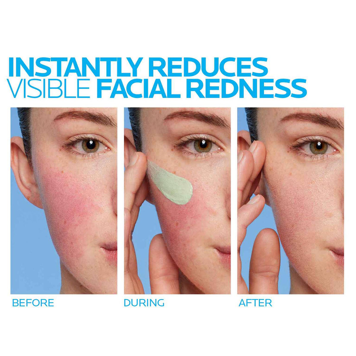 toleriane-rosaliac-ar-face-cream-for-visible-redness-q0 8_Toleriane_Rosaliac-AR-before-after.jpg 8_Toleriane_Rosaliac-AR-before-after_52d4967404aa.jpg