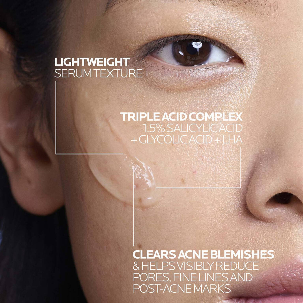 effaclar-salicylic-acid-acne-treatment-serum-r5 LaRochePosay-Product-Effaclar-Effaclar-Serum-30ml-3337875722827-Texture-REV.jpg LaRochePosay-Product-Effaclar-Effaclar-Serum-30ml-3337875722827-Texture-REV_243050550f1c.jpg