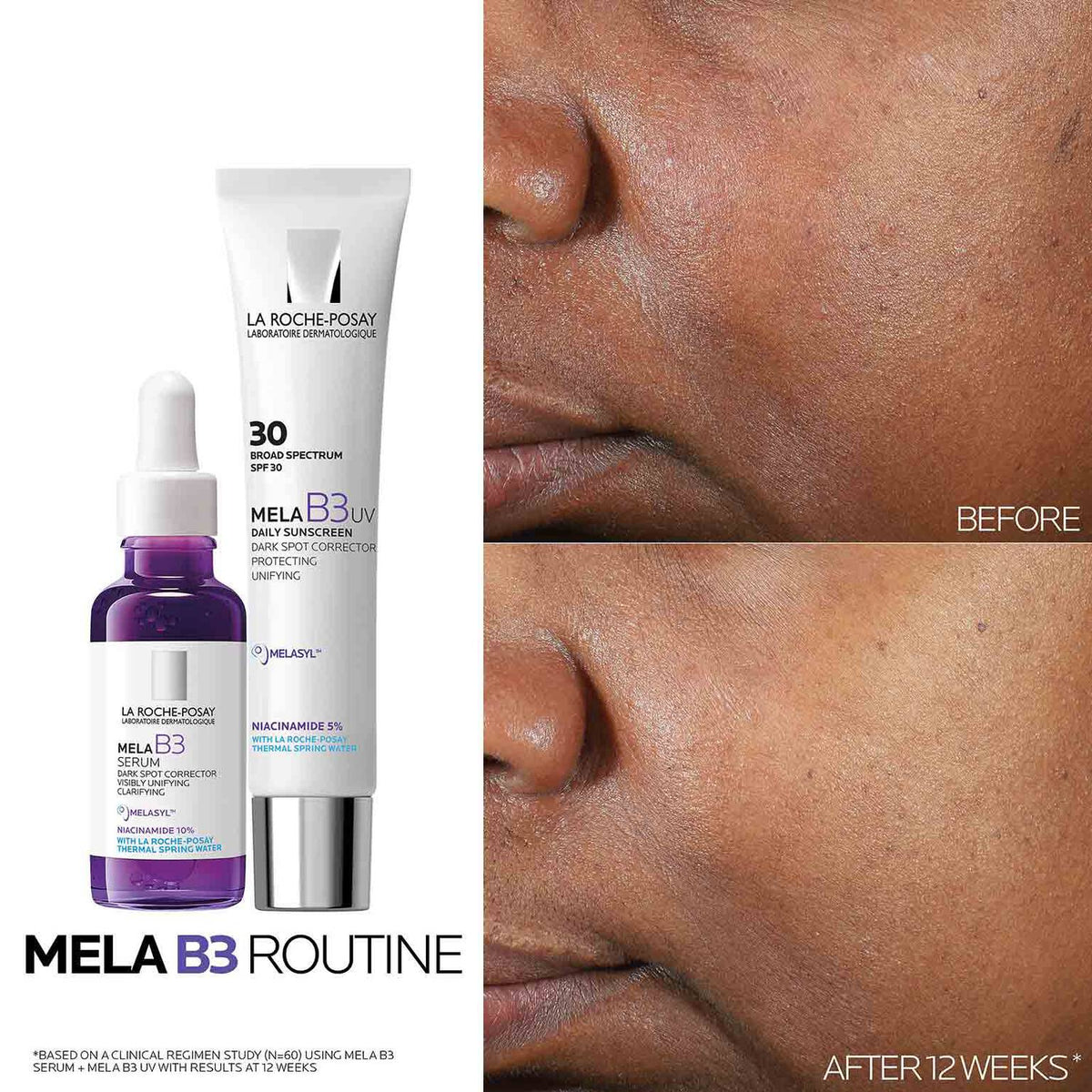 mela-b3-uv-daily-moisturizer-spf-30-with-melasyltm-niacinamide-s4 Mela-B3-routine_1500X1500.jpg Mela-B3-routine_1500X1500_4218e8d2a51a.jpg