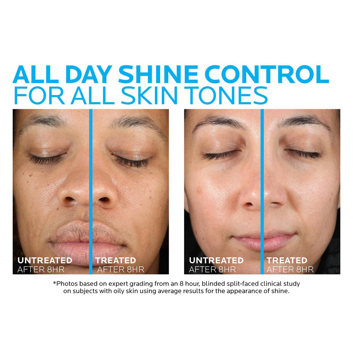 toleriane-double-repair-matte-face-moisturizer-for-oily-skin-n8 la-roche-posay-toleriane-matte-moisturizer-before-and-after-pdp-alt.jpg la-roche-posay-toleriane-matte-moisturizer-before-and-after-pdp-alt_29894fb3234d.jpg